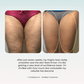 Glovea™ - EMS + Red Light Lymphatic Drainage Sculpting System
