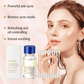 Glovea™ - Acne Buster