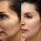 Glovea™ - Instant Face Tightening Cream