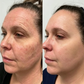 Glovea™ - Instant Face Tightening Cream